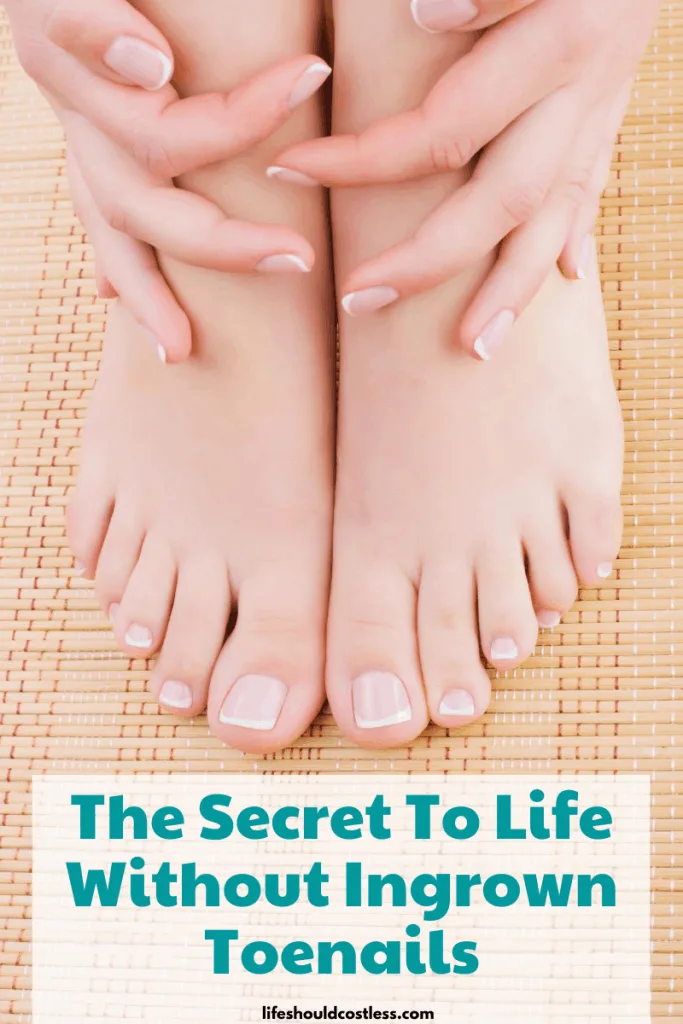 The Secret To Life Without Ingrown Toenails - Life Should Cost Less