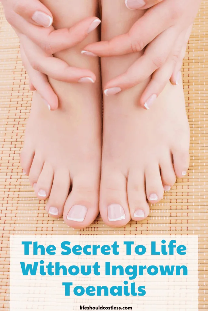 How to stop ingrown toenail.