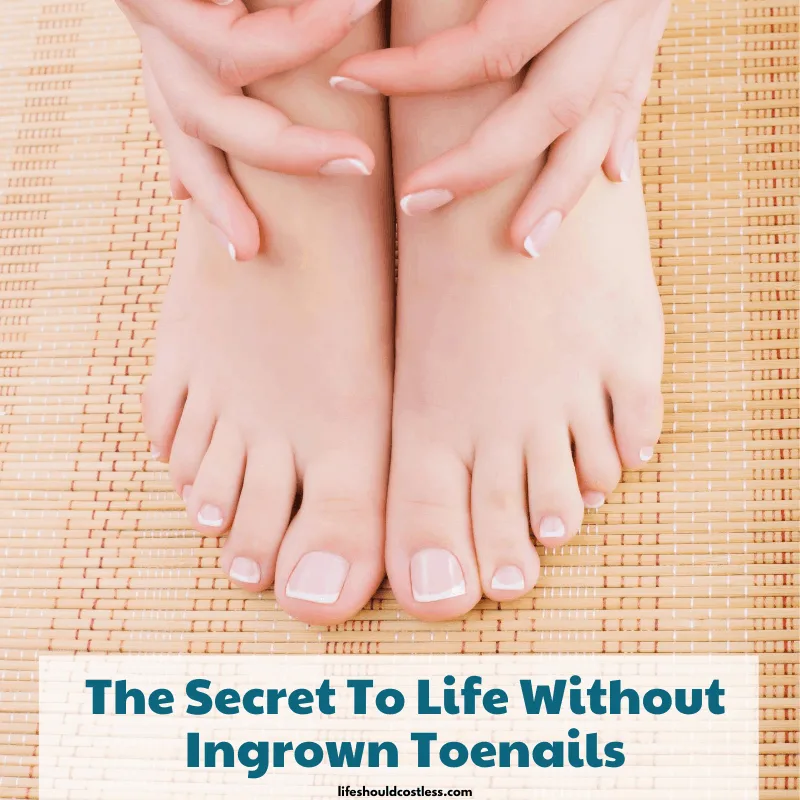 DIY Ingrown Toenail Hack